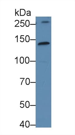 KTN1 / Kinectin Antibody (aa1162-1325)