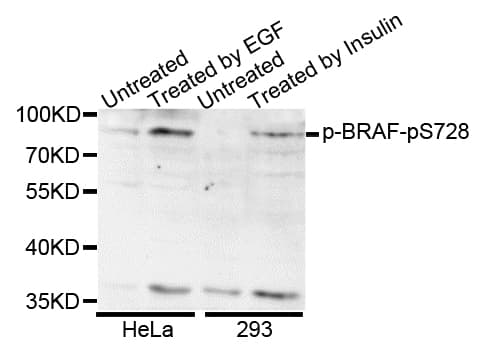BRAF / B-Raf Antibody (phospho-Ser728)