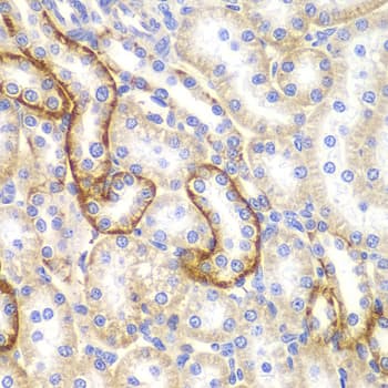 CLDN1 / Claudin 1 Antibody