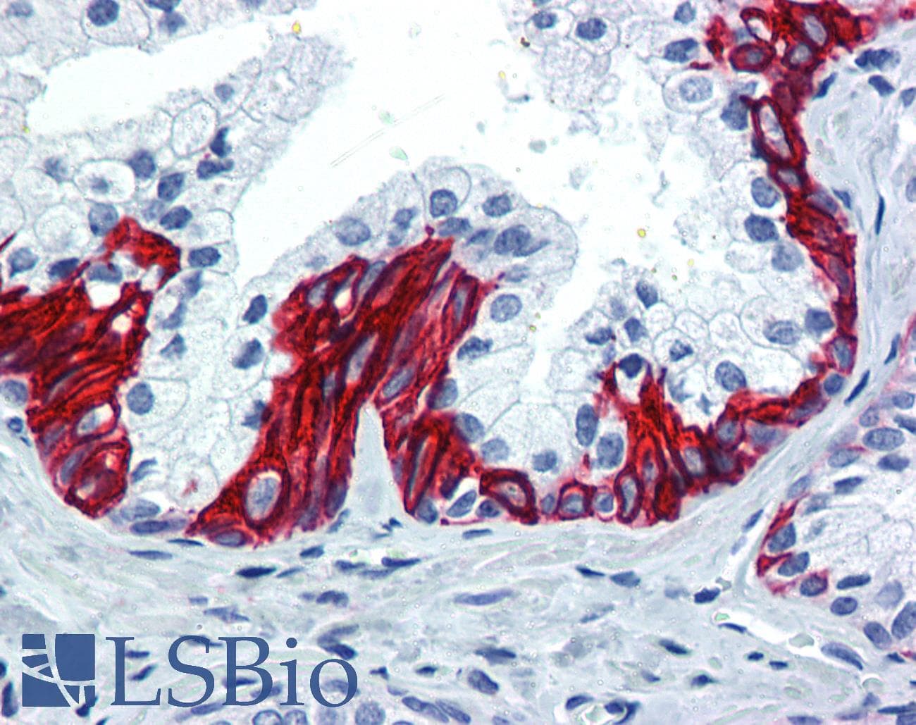 IHC-plus™ CST1 / Cystatin SN Antibody (aa31-80)