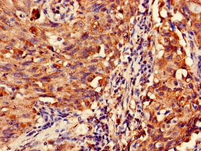 Polyclonal Rabbit anti-Human MAS1L / MRG Antibody (IHC, WB)