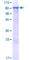 Human ZUFSP Protein (Recombinant GST)