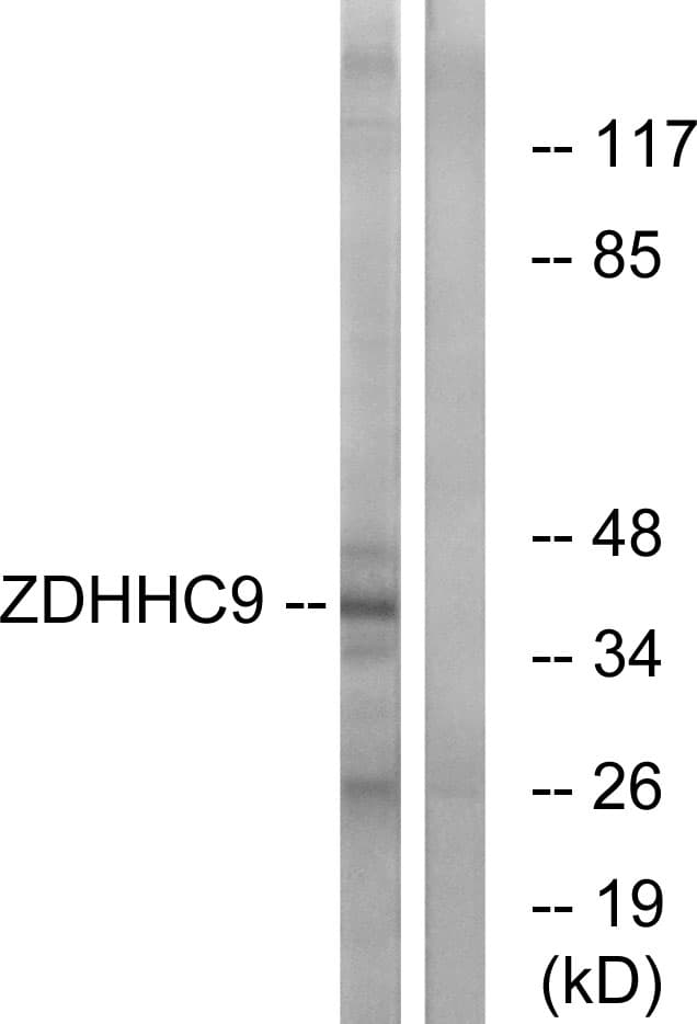 IHC-plus™ ZDHHC9 Antibody (aa315-364)