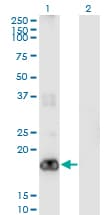 PIGH Antibody (clone 2F8)