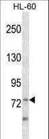 ZBTB39 Antibody (aa231-258)