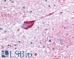 PathPlus™ Polyclonal Rabbit anti-Human GPR32 Antibody (Extracellular Domain, IHC)
