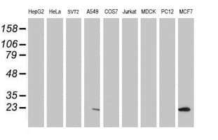 PYCARD / ASC / TMS1 Antibody (clone OTI2A7)