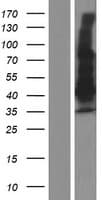 MAGEA9B Protein (Over-Expression Lysate Myc-DDK (Flag))