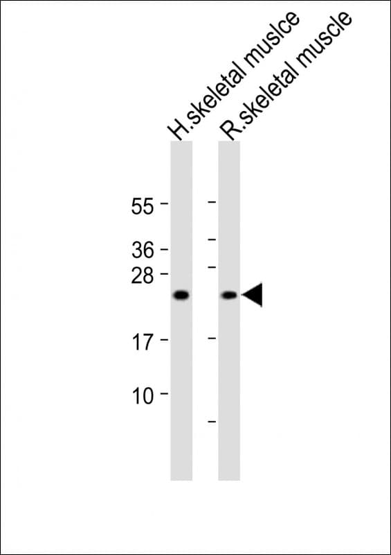 MLC3F / MYL1 Antibody (N-Terminus)