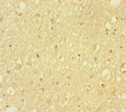 HDAC5 Antibody