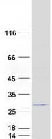 Human EMC7 Protein (Recombinant Myc-DDK (Flag))