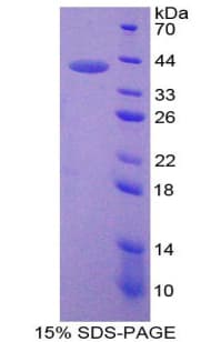 Mouse NMB / Neuromedin B Protein (Recombinant His-GST)