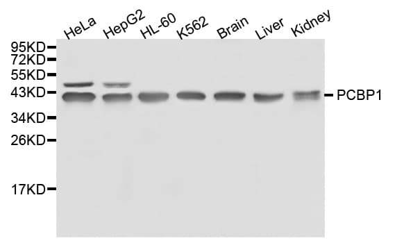 Polyclonal Rabbit anti-Human HnRNP-E1 / PCBP1 Antibody (IHC, IF, WB)