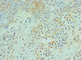 SRPK1 Antibody (aa290-480)