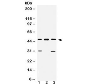 Polyclonal Rabbit anti-Human E2F3 Antibody (WB)