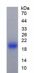 Mouse IL1RN Protein (Recombinant His)