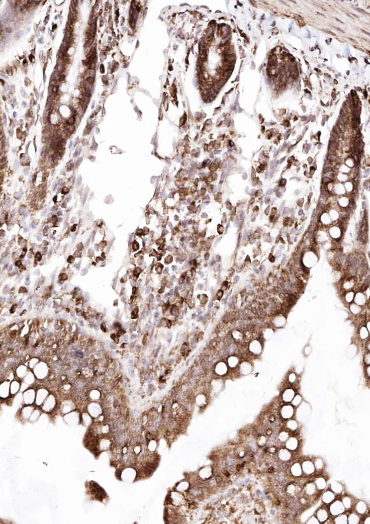 Polyclonal Rabbit anti-Human SSR3 / TRAP-Gamma Antibody (aa8-23, IHC, WB)