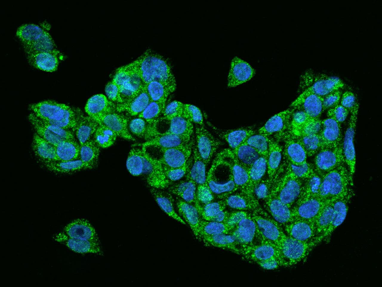 FGF1 / Acidic FGF Antibody