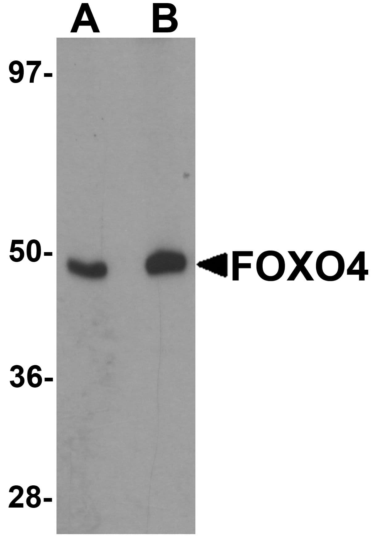 IHC-plus™ FOXO4 / AFX1 Antibody