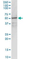 IHC-plus™ GNAI1 / Gi Antibody (clone 2B8-2A5)