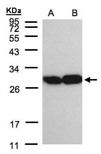TPI1 / TPI Antibody (aa187-249)