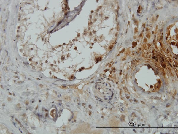 TRIM49 Antibody (clone 2E5)