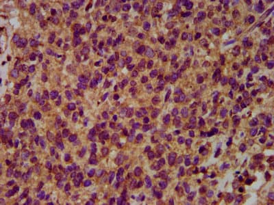 Polyclonal Rabbit anti-Human NEDL2 / HECW2 Antibody (IHC, IF, WB)