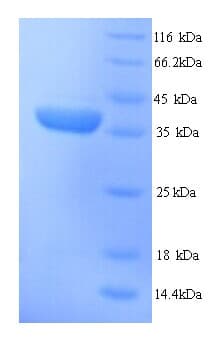 Mouse H2-D1 Protein (Recombinant His)