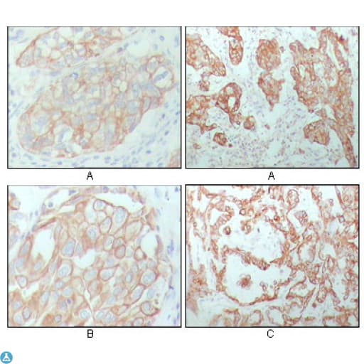 KRT8 / CK8 / Cytokeratin 8 Antibody