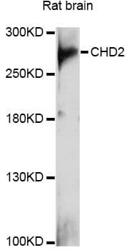 Polyclonal Rabbit anti-Human CHD2 Antibody (WB)
