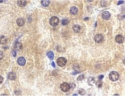 IL1RL1 Antibody