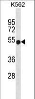 WAS / WASP Antibody (aa205-234)