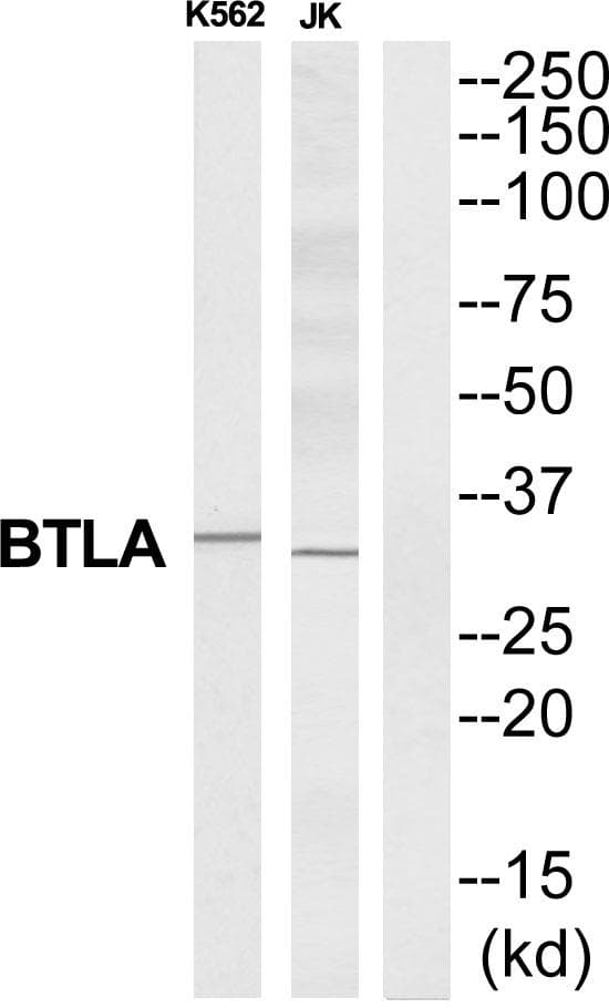 Polyclonal Rabbit anti-Human BTLA / CD272 Antibody (WB)