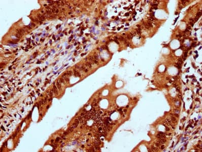 HIST1H2BN Antibody