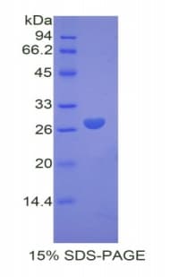 Mouse F9 / Factor IX Protein (Recombinant His)
