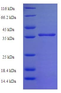 Human C11orf73 Protein (Recombinant His-SUMO)