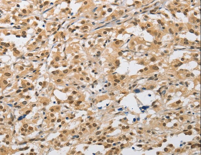 AMZ2 Antibody