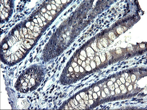 ANKMY2 Antibody (clone OTI1C12)