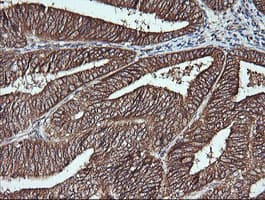 MSI2 Antibody (clone OTI2F10)