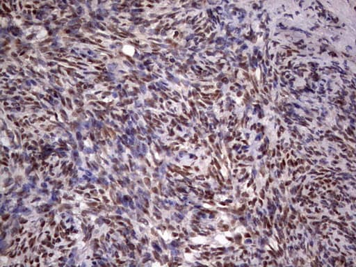 C14orf166 Antibody (clone OTI1E5)
