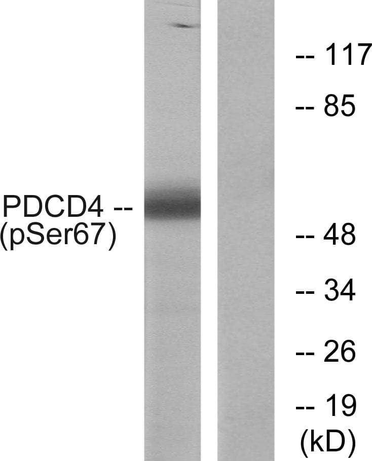 PDCD4 Antibody (phospho-Ser67)