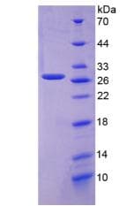 Human FOLR1 / Folate Receptor Alpha Protein (Recombinant His)