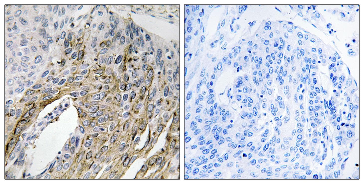LONP2 / LONP Antibody