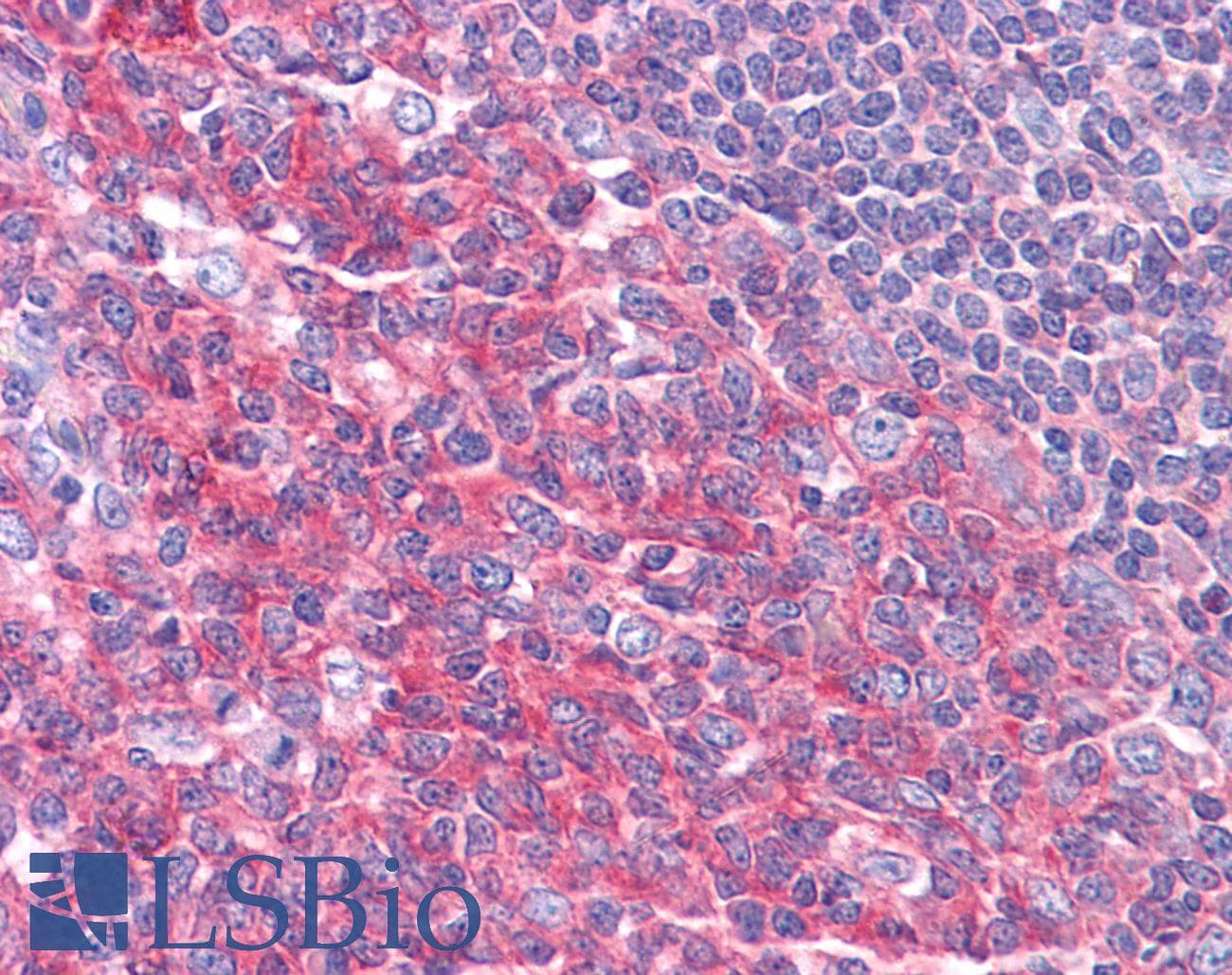 IHC-plus™ KARS Antibody (clone 8G12C1)