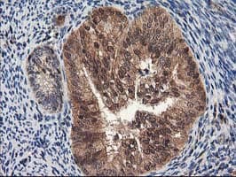 NUDT18 Antibody (clone OTI5F9)