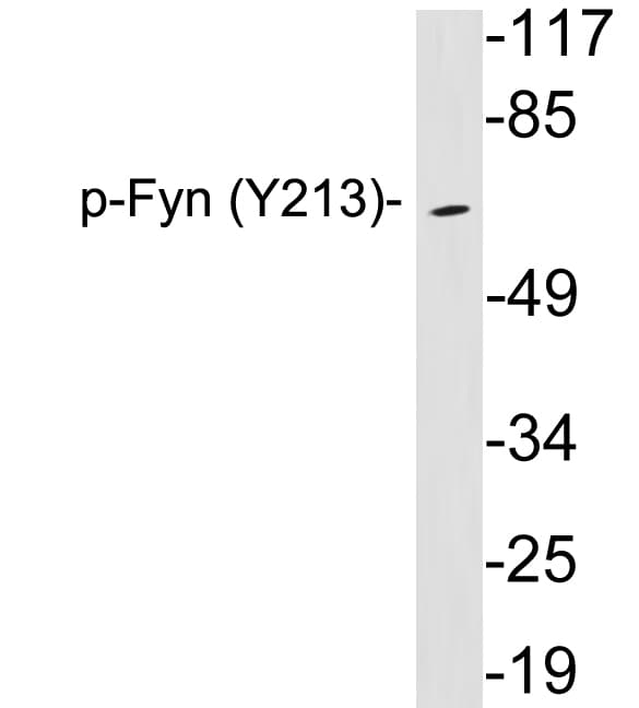 Polyclonal Rabbit anti-Human SYN / FYN Antibody (phospho-Tyr213, WB)