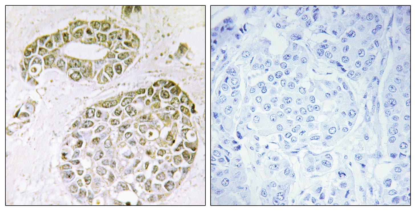 HNRPM / HNRNPM Antibody (aa11-60)