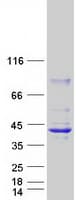 Human HSD17B2 Protein (Recombinant Myc-DDK (Flag))