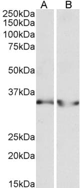 IHC-plus™ LDHB / Lactate Dehydrogenase B Antibody (aa15-25)