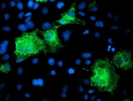 KATNB1 Antibody (clone OTI5E1, Carrier-free)